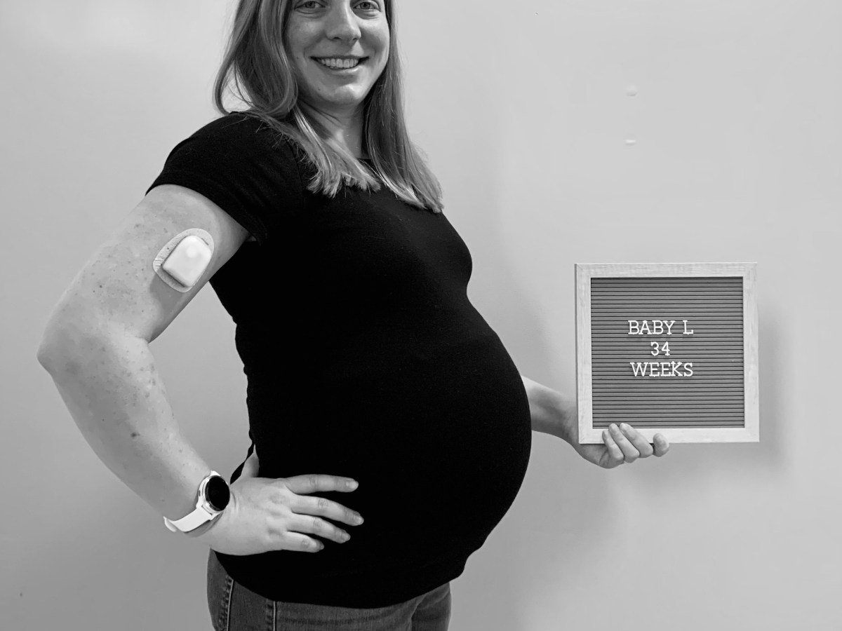 Review of Using the Omnipod 5 Insulin Pump During&nbsp;Pregnancy